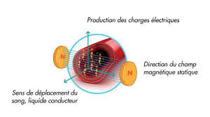 effets de bracelet magnetique en cuivre